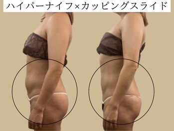 サロンハート(Salon Heart)/