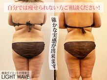 ライトウェーブ 松本村井本店の雰囲気（松本市/痩身/ダイエット/ハイパーナイフ/小顔/ブライダル）