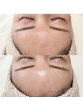 フェリノ(FERINO)/エンビロンソノイオンコース