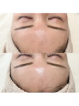 フェリノ(FERINO)/エンビロンソノイオンコース