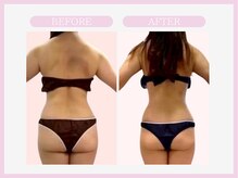 スリムライン 盛岡店(The Slim Line)/before→after