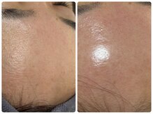 マロン 能町(Marron)