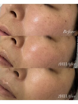 ラ クレール ビューティーサロン(LA CLAIR)/ホワイトラボ