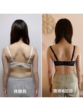 マホラ 本店(Mahora)/背肉・脇肉にサヨウナラ