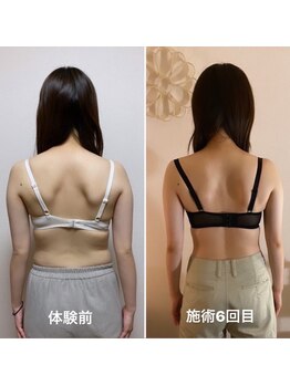 マホラ 本店(Mahora)/背肉・脇肉にサヨウナラ