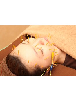 鍼灸施術を受けたい