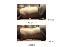 グランツ 小山店/インディバ施術　お腹集中コース