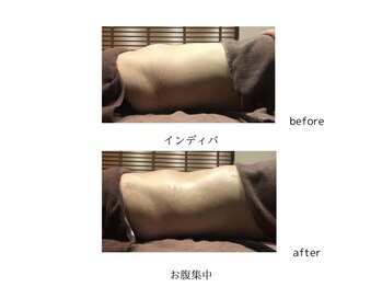 グランツ 小山店/インディバ施術　お腹集中コース