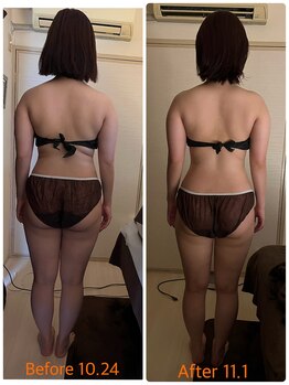 エイド(aide)/ビフォーアフター