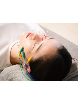 小顔になりたい