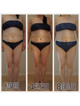 ホロニック ベルサンテ(Holonic Belle Sante)/メディセルハイブリッド