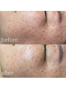 エメリーヌ(AIMELINE)/クリスティーナ ビオフィート