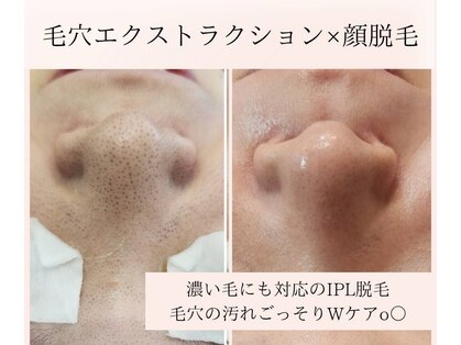 アナシアビューティーサロン(Anacia)の写真