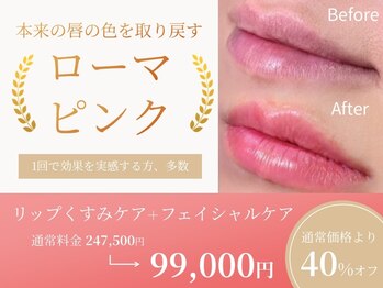 エスビーエス トウキョウ 大森店(SBS TOKYO)/ローマピンクリップ