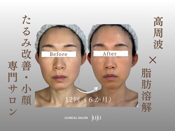 ジュジュ(juju)/横顔にドキッとしたら始め時。