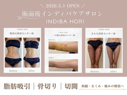 インディバホリトウキョウ(INDIBA HORI TOKYO)の写真