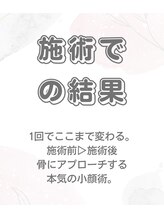 小顔整体研究所 KSラボ 藤が丘店/