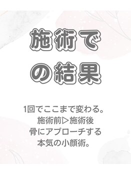 小顔整体研究所 KSラボ 藤が丘店/