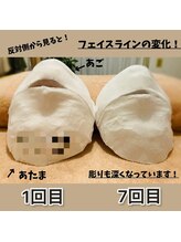 ロータス ビューティー(LOTUS Beauty)/1回目のパックを保存出来ます。