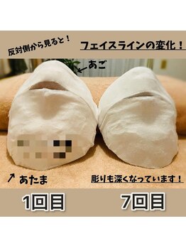 ロータス ビューティー(LOTUS Beauty)/1回目のパックを保存出来ます。