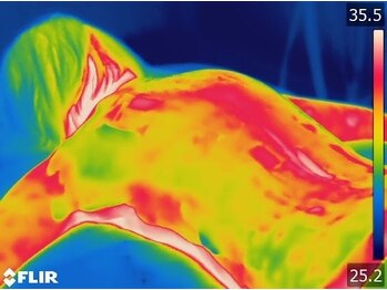 リリ(RILI)/マシーン施術後の冷え改善→