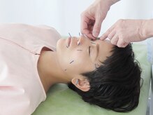 明大前はり灸院の雰囲気（美容鍼で即効リフトUP！ハリツヤUPで自信あふれる私へ）