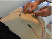 メイロン(meilong)/施術風景