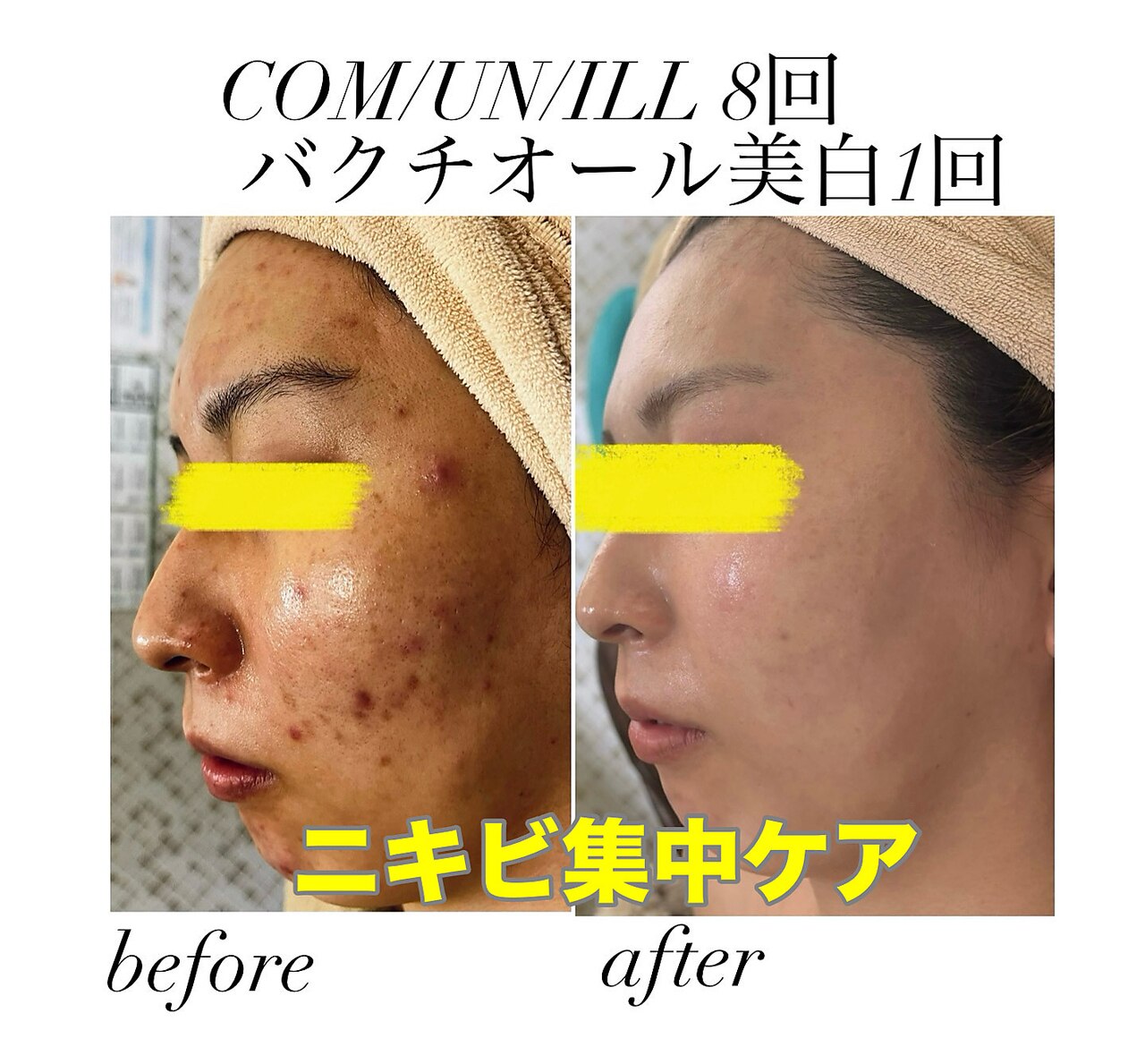 品川区で光フェイシャルが人気のエステサロン｜ホットペッパービューティー