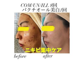 マスカレード(Masquerade)