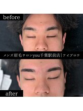 ユー 千葉駅前店(you)/ビフォ－アフター写真