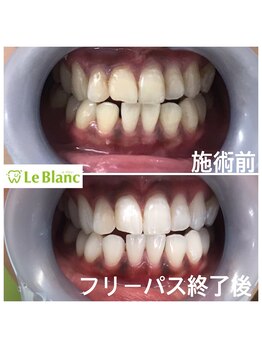 ルブラン 奈良店(Le Blanc)/大変身!