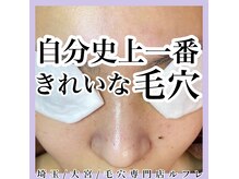 頑固な毛穴の黒ずみ、角栓詰まり、皮脂詰まりも綺麗ツルツルに！