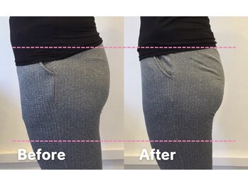 ユズ(yuzu)/太もも前・横張りが気になる