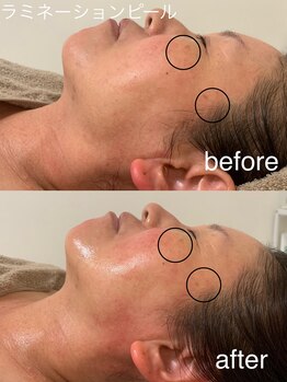 ニコ(25)/ラミピール