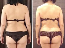 美容整体 ウェリナ 蟹江院/小顔矯正/骨盤矯正/美脚サロン