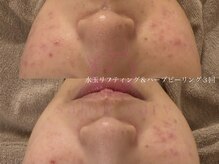 サロンヴェアリー 広尾(salon vary)/#ブライダル#お急ぎ#2ヶ月#プレ