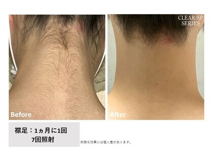 サニーサイド(Sunny side)の写真