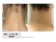 サニーサイド(Sunny side)の写真