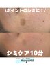 HPB限定【ピンポイントケア】シミにお悩みの方に¥9,900→¥7,700