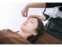ふしぎの森鍼灸整骨院の雰囲気（美容鍼灸もございます。）