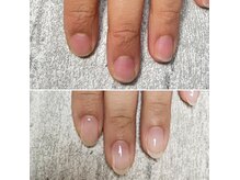 ナナラ(nanala)の雰囲気（＜自爪育成＞チビ爪、貝爪、噛み爪、爪のピンク部分伸ばしたい方）