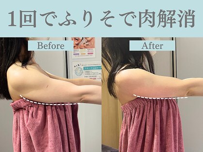 フローフシ∞の写真