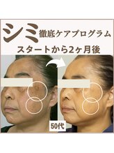 スイッチ(Switch)/シミ徹底ケアプログラム2ヶ月で!