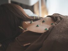 ヒノト(Hinoto)の雰囲気（お身体全体を整えて、首こり/肩こり/腰痛などを根本から改善☆）