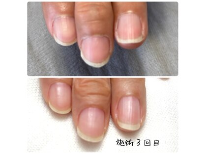 ミータイムネイル(me-time nail)の写真