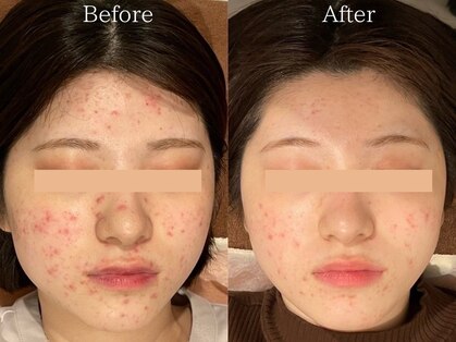ライフサロン 別府(Life Salon)の写真