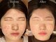 ライフサロン 別府(Life Salon)の写真