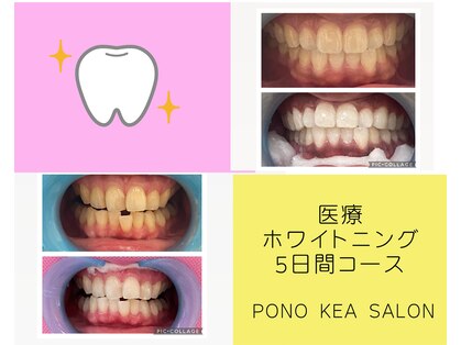 ポノケアサロン(PONO KEA SALON)の写真