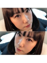 ラウレア(laule'a)/初めてのエクステなら120本