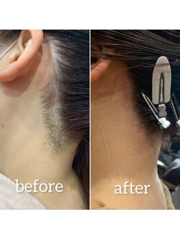 デザインファム(DESIGN FAM)/うなじワックス脱毛☆